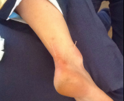 gallery/acupuncture 2